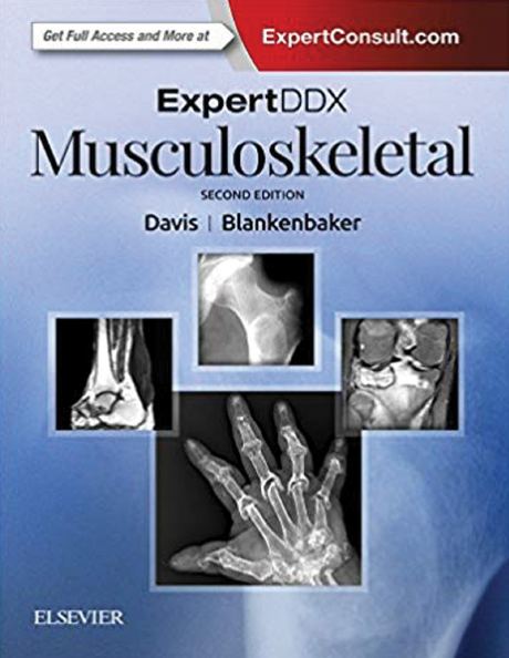 ExpertDDx Musculoskeletal Second EditionE-Book.png