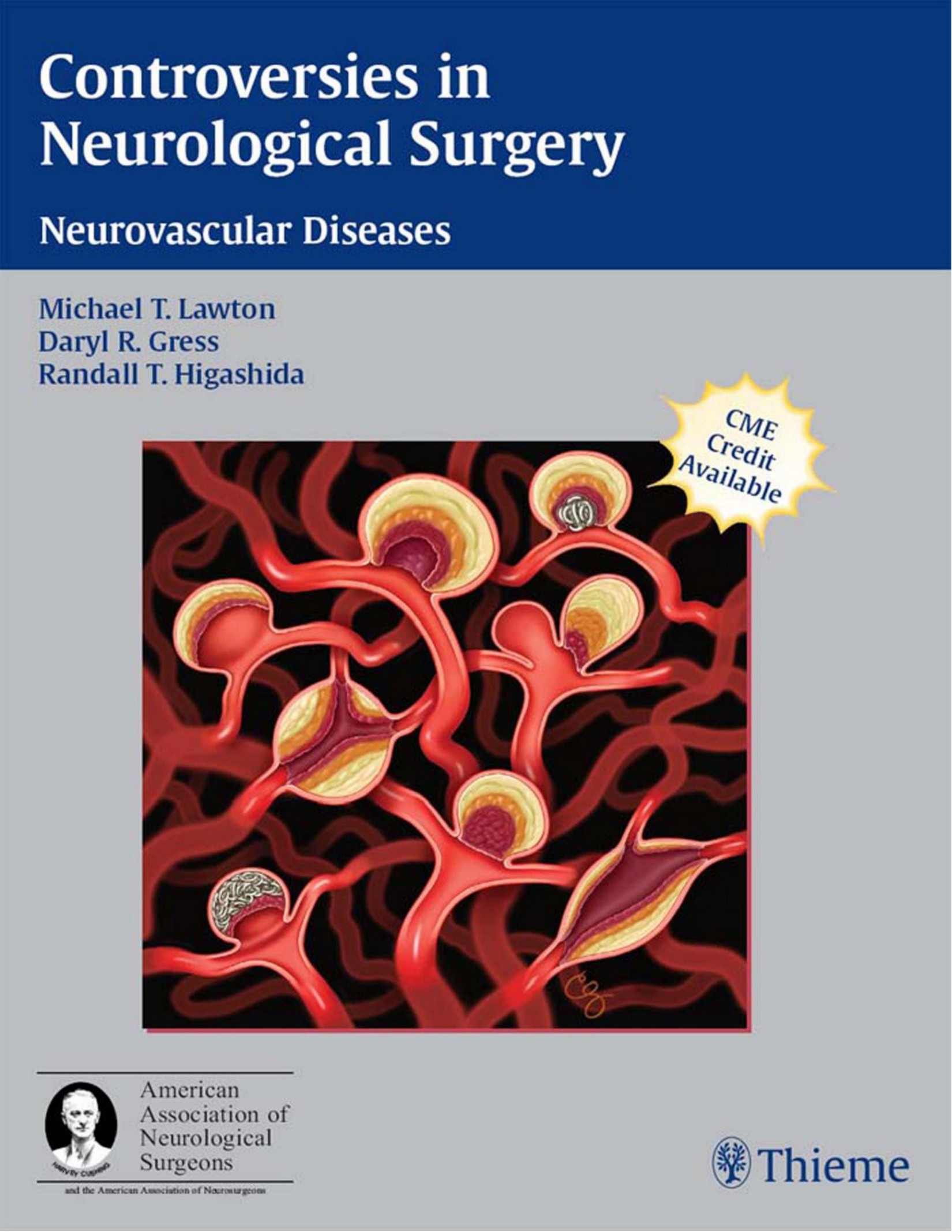 Controversies in Neurological Surgery-Neurovascular Diseases.jpg