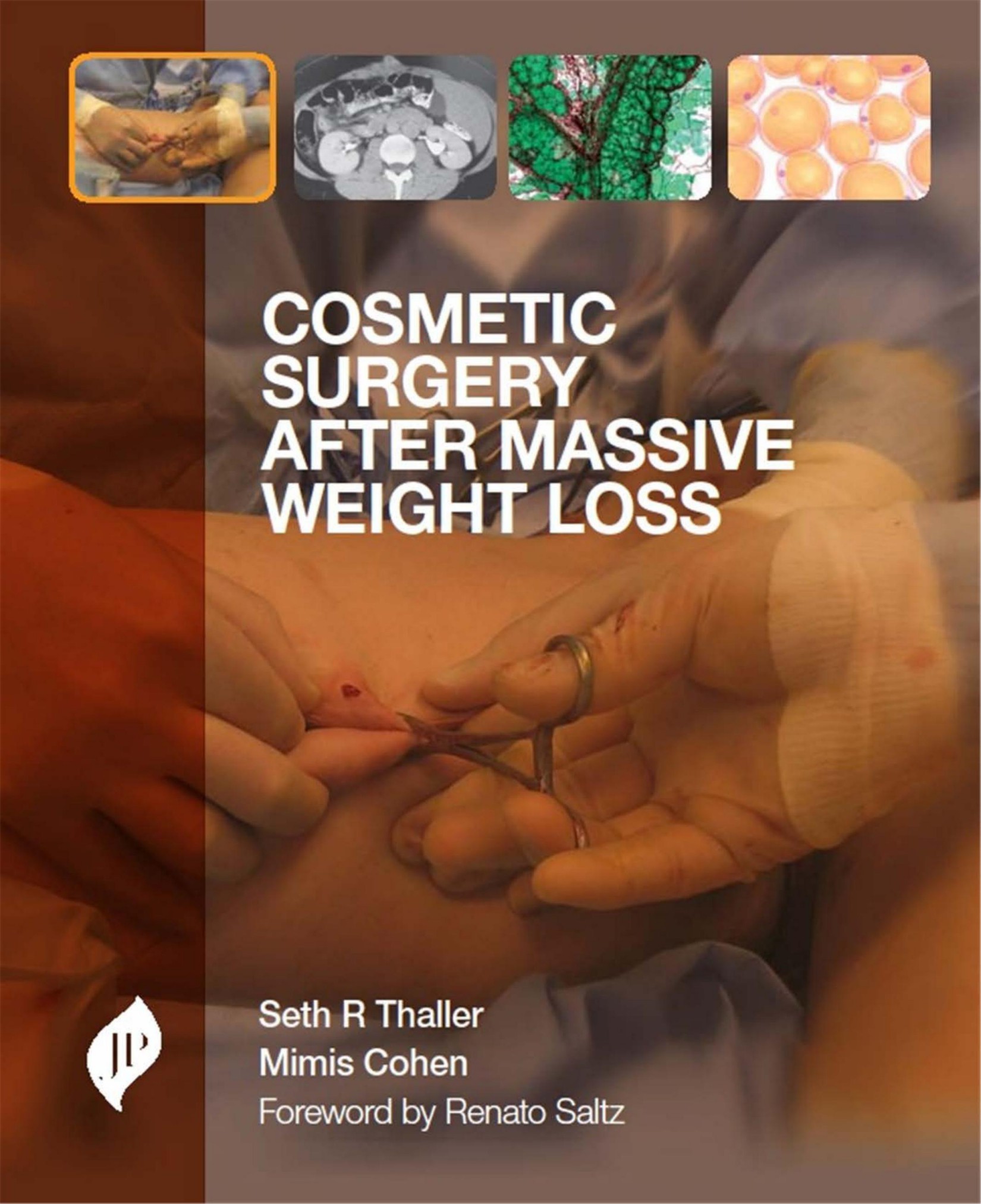 Cosmetic Surgery After Massive Weight Loss.jpg