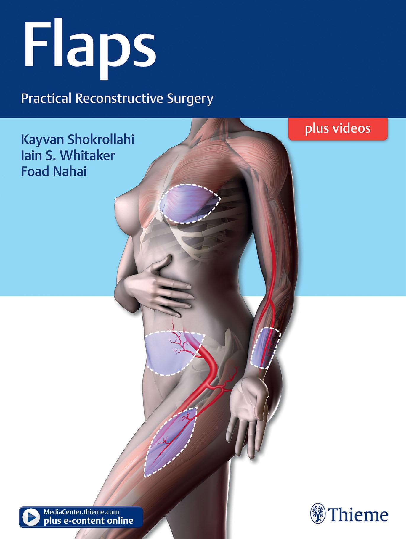 Flaps Practical Reconstructive Surgery.jpg