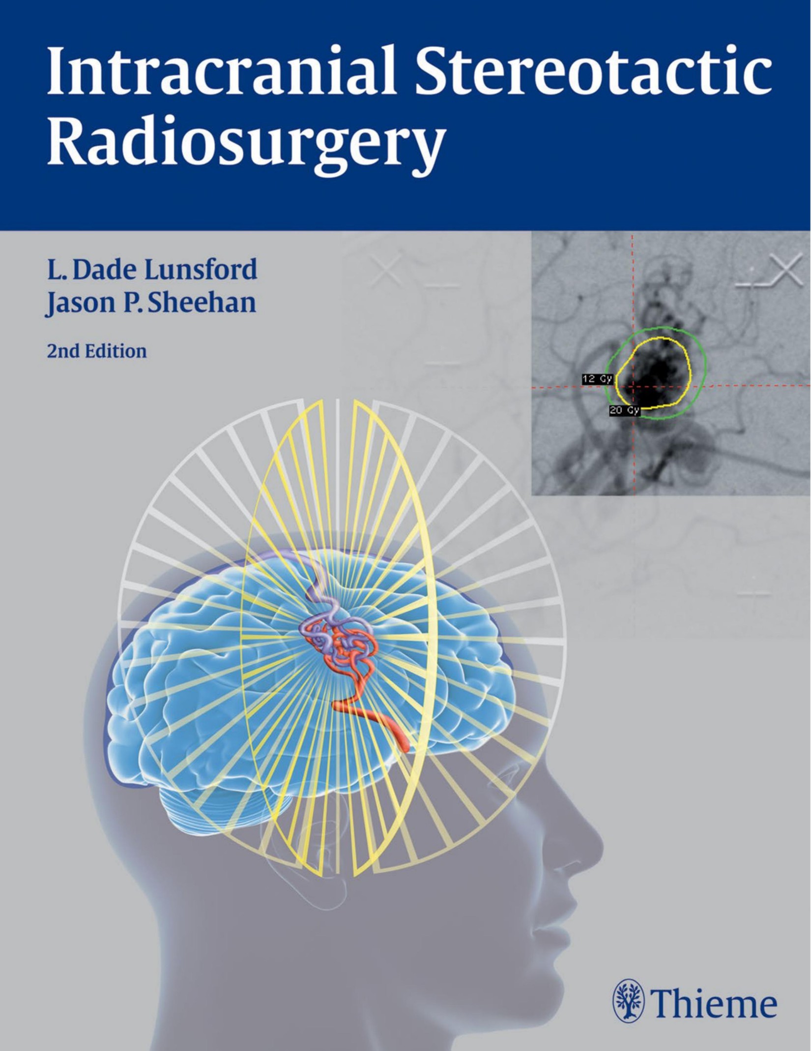 Intracranial Stereotactic Radiosurgery 2nd Edition.jpg