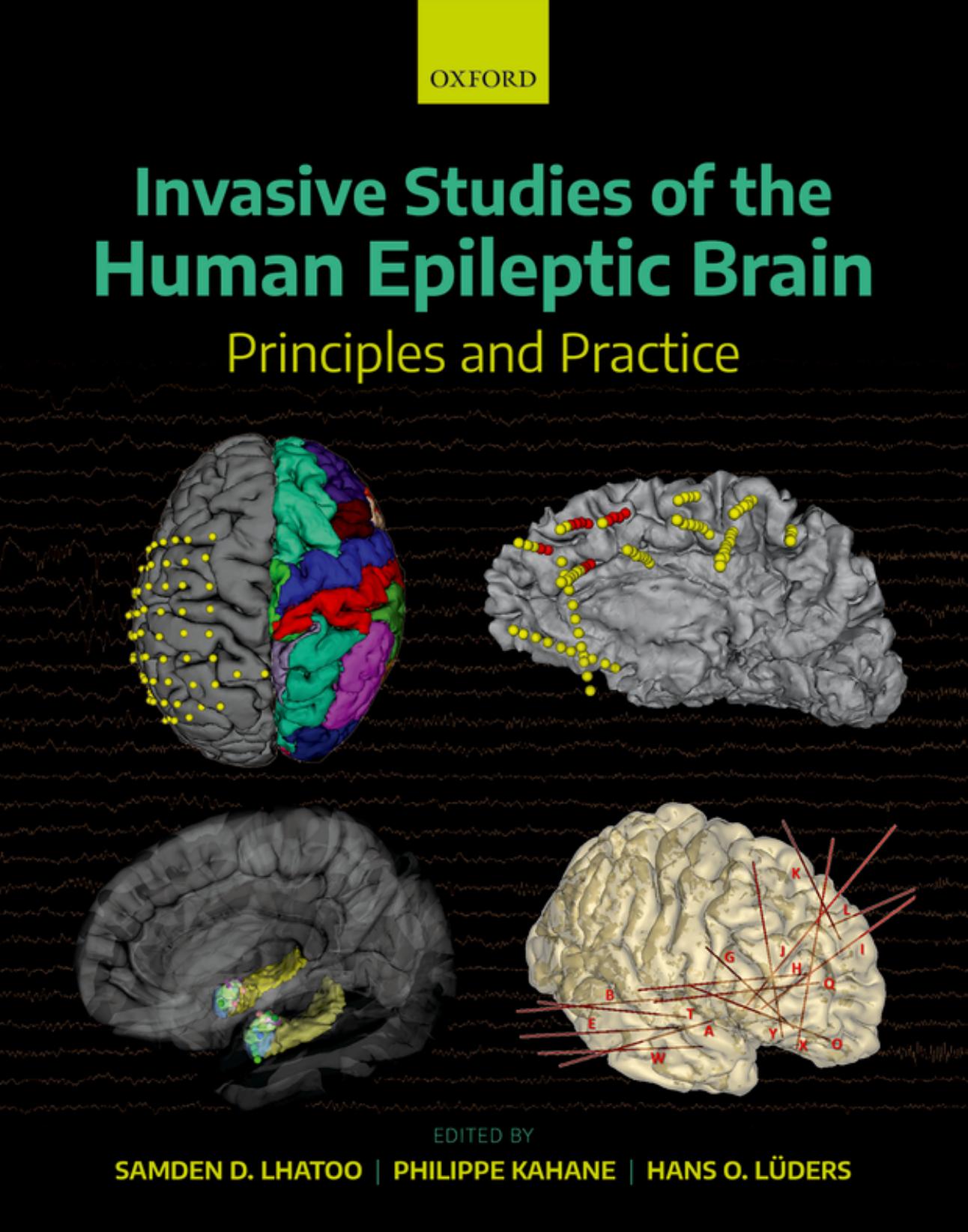 Invasive Studies of the Human Epileptic Brain Principles and Practice - Samden D. Lhatoo,Philippe Kahane,Hans O. Luders.jpg