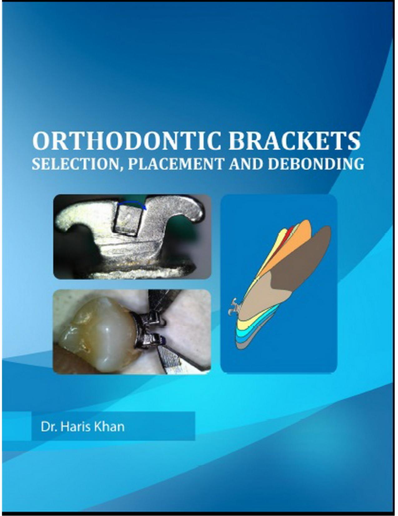Orthodontic Brackets Selection, Placement and Debonding.jpg
