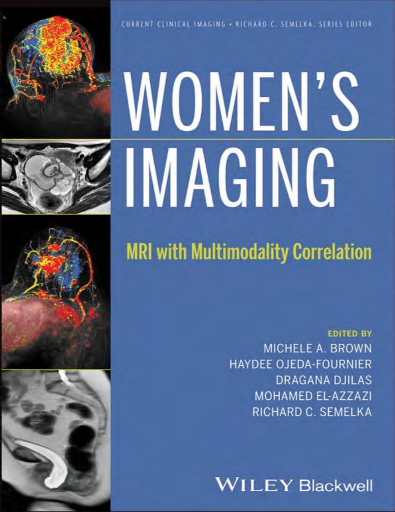 Women's Imaging_ MRI with Multimodality Correlation - Michele A. Brown, Haydee Ojeda-Fournier, Dragana Djilas, Mohamed El-Azzazi, Richard C. Semelka.jpg