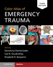 Color Atlas of Emergency Trauma 3rd edition.jpg