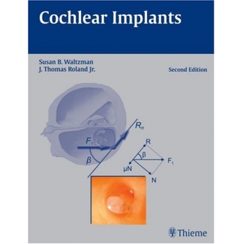 Cochlear Implants 2ed