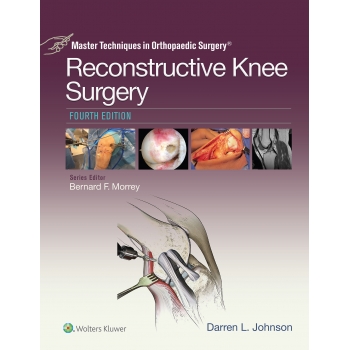 Reconstructive Knee Surgery 4e