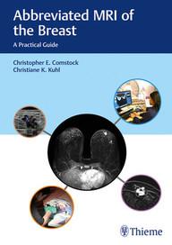 Abbreviated MRI of the Breast The Practical Guide