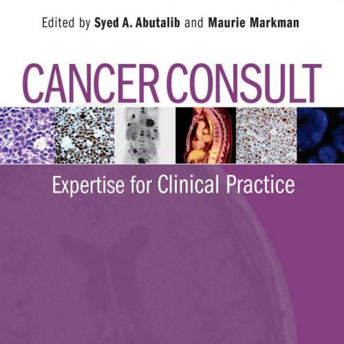 Cancer Consult Expertise for Clinical Practice