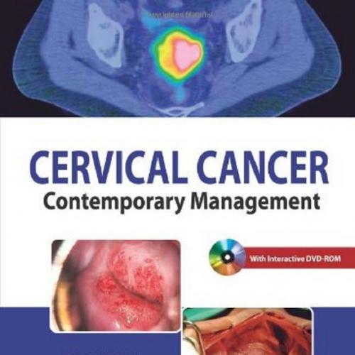 Cervical Cancer-Contemporary Management