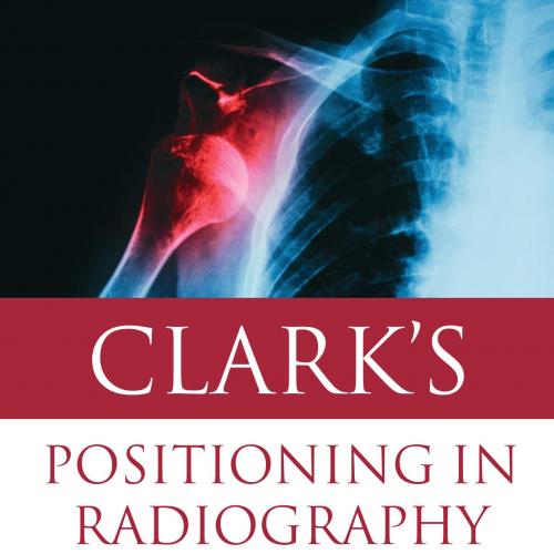 Clark's Positioning in Radiography 13E-Whitley, A. Stewart, Sloane, Charles, Hoadley, Graham, Jefferson, Gail