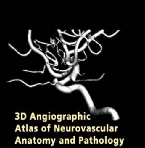 3D Angiographic Atlas of Neurovascular Anatomy and Pathology - Neil M. Borden