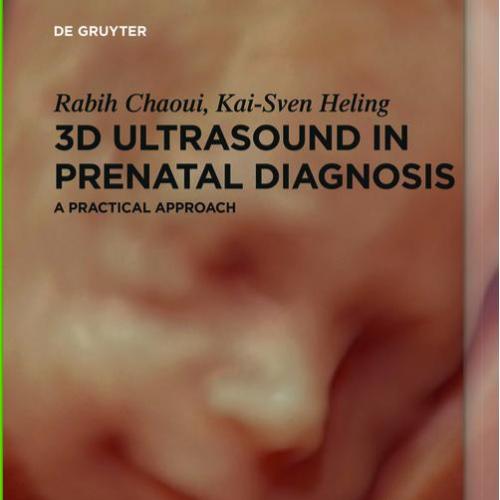 3D Ultrasound in Prenatal Diagnosis A Practical Approach