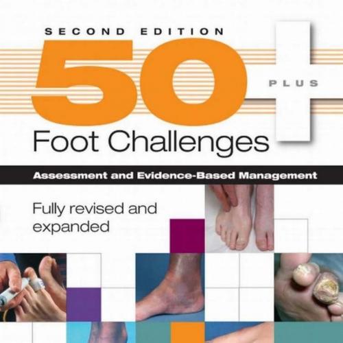 50_ Foot Challenges Assessment and Evidence-Based Management, 2nd Edition