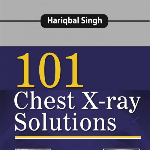 101 Chest X-ray Solutions