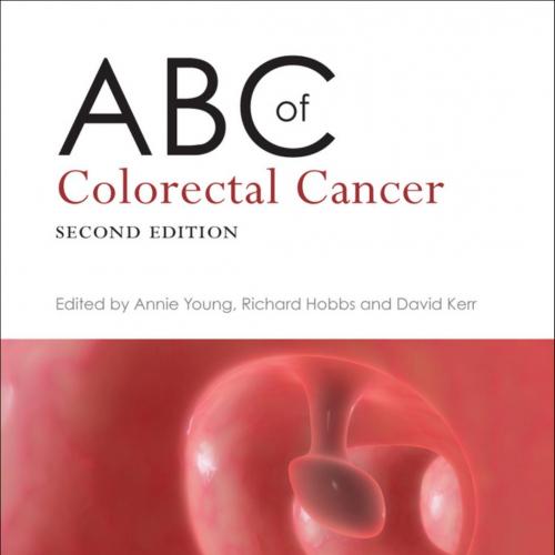 ABC of Colorectal Cancer,2nd Edition