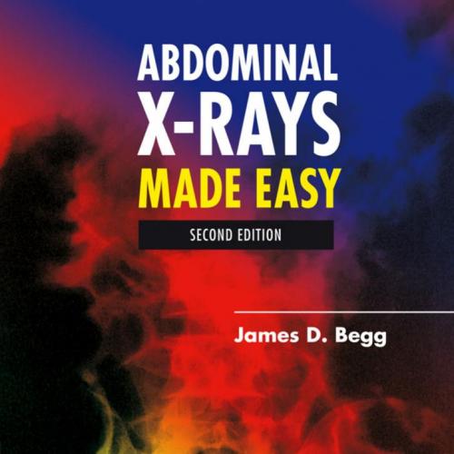 Abdominal X-Rays Made Easy, 2nd Edition