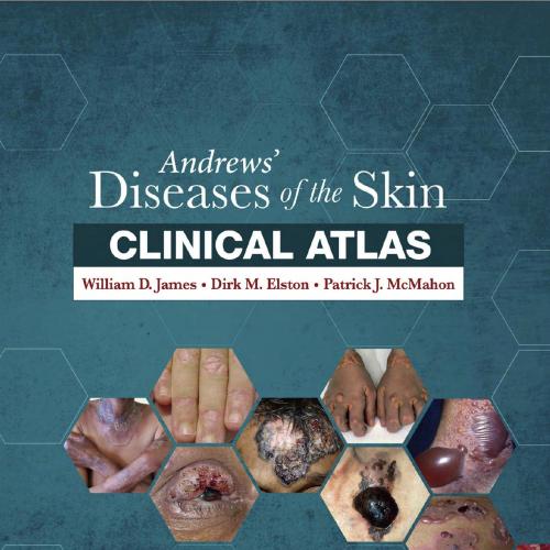 Andrews' Diseases of the Skin Clinical Atlas 1th