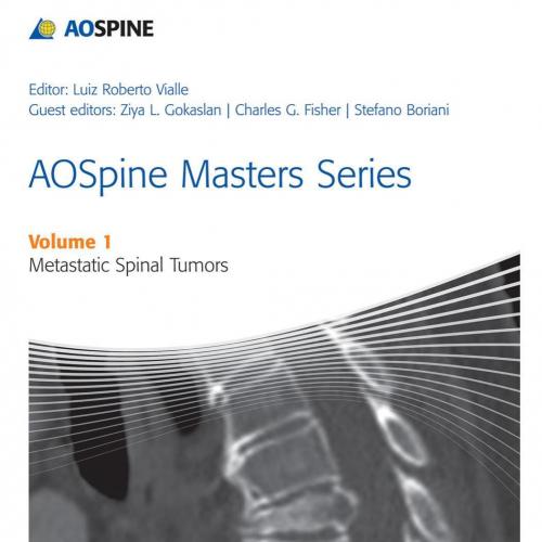 AOSpine Masters Series Volume 1_ Metastatic Spinal Tumors - Boriani, Stefano, Vialle, Luiz Roberto Gomes, Gokaslan, Ziya L_