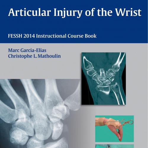 Articular Injury of the Wrist-FESSH 2014 Instructional Course Book, 1E (2014) - Wei Zhi