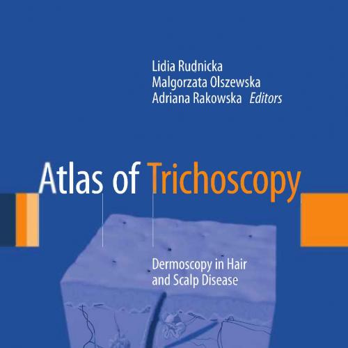 Atlas of Trichoscopy-Dermoscopy in Hair and Scalp Disease - Wei Zhi