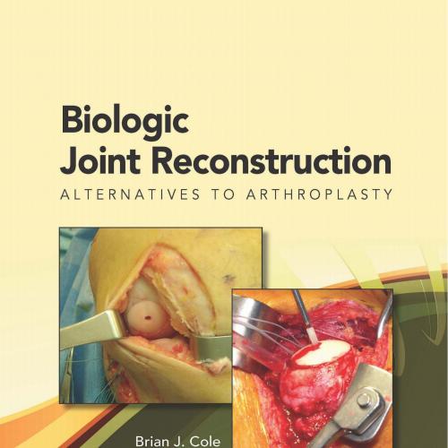 Biologic Joint Reconstruction Alternatives to Arthroplasty
