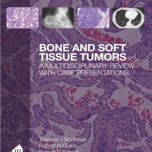 Bone and Soft Tissue Tumors A Multidisciplinary Review with Case Presentations