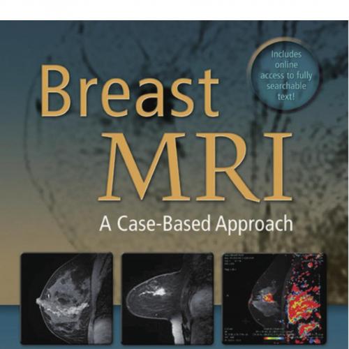 Breast MRI A Case-Based Approach