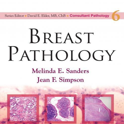 Breast Pathology (Consultant Pathology Volume 6)