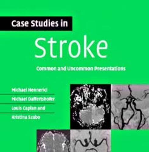 Case Studies in Stroke Common and Uncommon Presentations