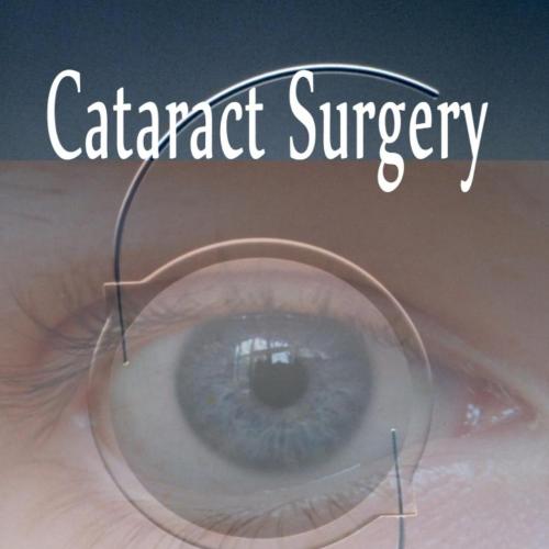Cataract Surgery by Farhan Husain Zaidi