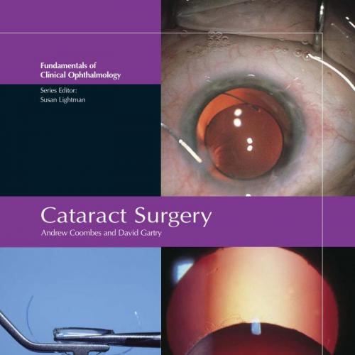 Cataract Surgery-FCO Series