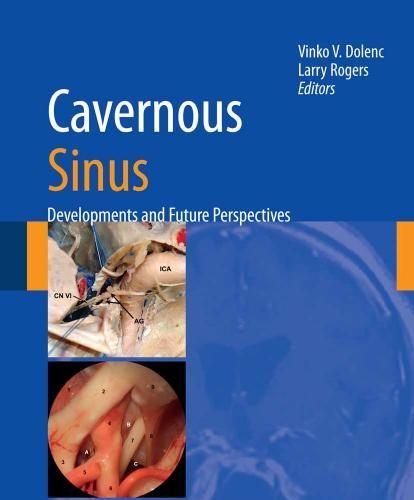 Cavernous Sinus Developments And Future Perspectives