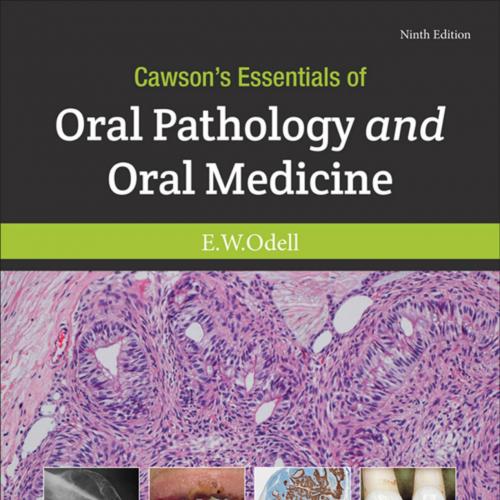 Cawson's Essentials of Oral Pathology and Oral Medicine - Wei Zhi