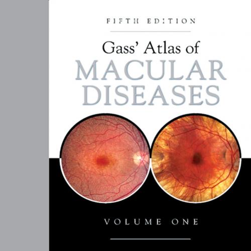 Gass' Atlas of Macular Diseases, 5th Edition 2-Volume Set