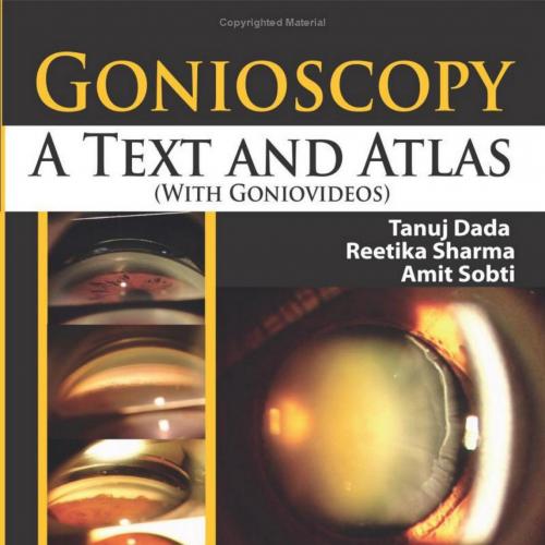 Gonioscopy A Text and Atlas (with Goniovideos)