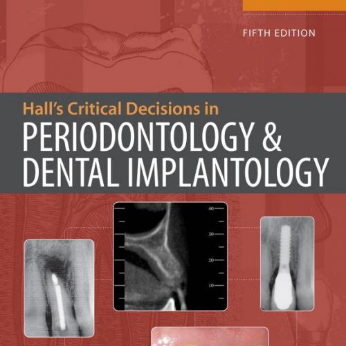 Hall’s Critical Decisions in Periodontology 5th Edition