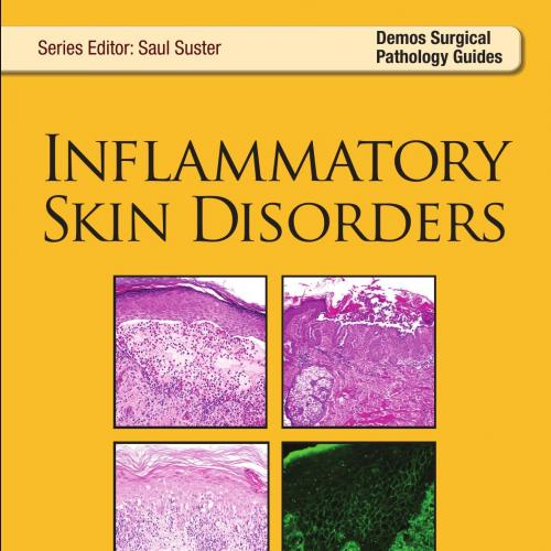Inflammatory Skin Disorders