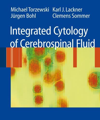 Integrated Cytology Of Cerebrospinal Fluid