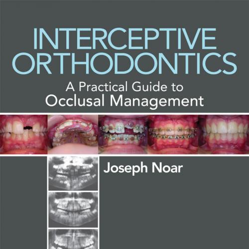 Interceptive Orthodontics_ A Practical Guide to Occlusal Management - Joseph Noar