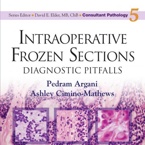 Intraoperative Frozen Sections-Diagnostic Pitfalls (2014)