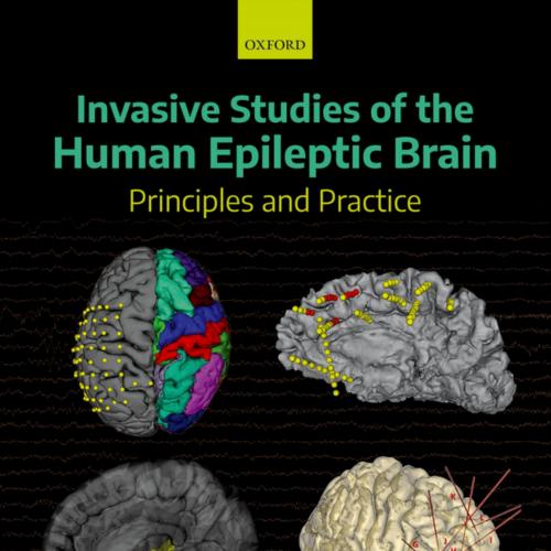 Invasive Studies of the Human Epileptic Brain: Principles and Practice 1st Edition