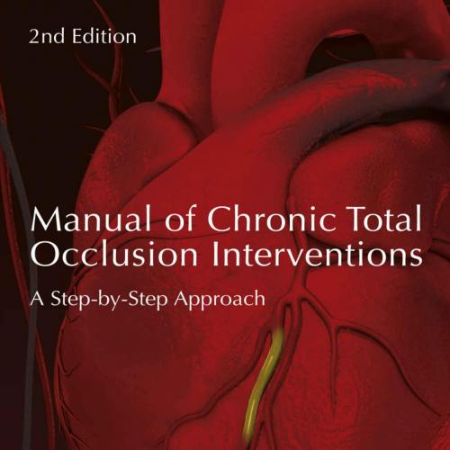 Manual of Chronic Total Occlusion Interventions A Step-by-Step Approach 2nd Edition