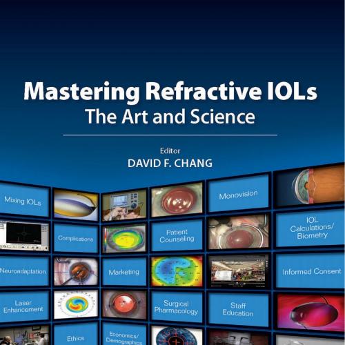 Mastering Refractive IOLs The Art and Science - Wei Zhi