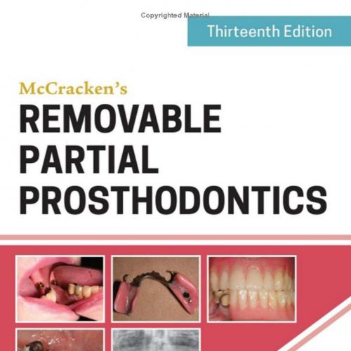 McCracken’s Removable Partial Prosthodontics 13th Edition