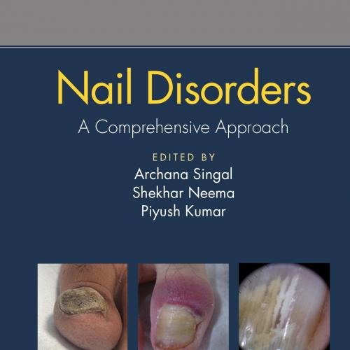 Nail Disorders_ A Comprehensive Approach - Archana Singal & Shekhar Neema & Piyush Kumar