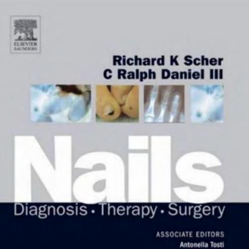 Nails-Diagnosis, Therapy, Surgery (3e)