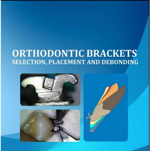 Orthodontic Brackets Selection, Placement and Debonding