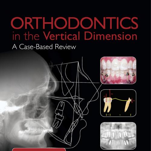 Orthodontics in the Vertical Dimension A Case-Based Review