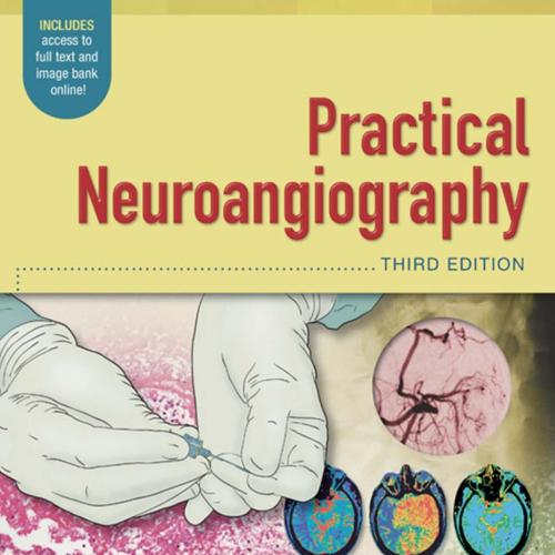 Practical Neuroangiography,3rd Edition